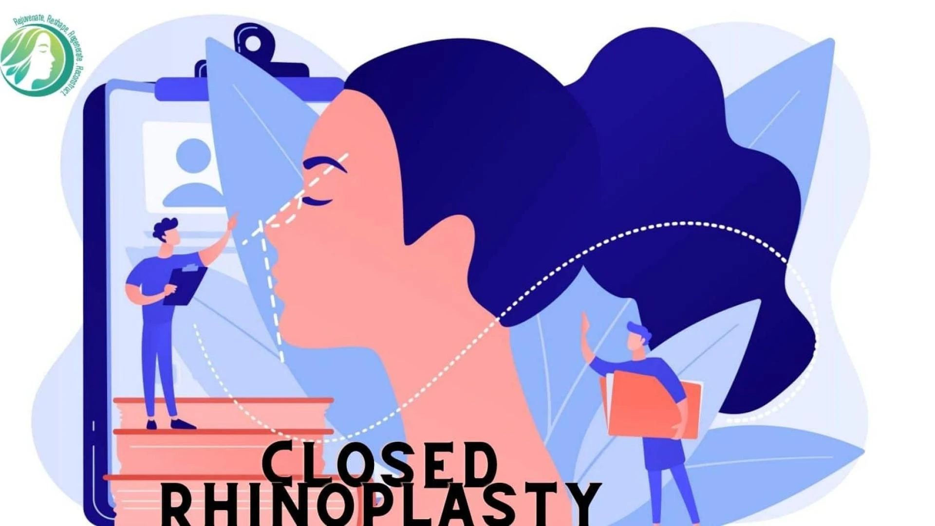 What is closed rhinoplasty? | A brief overview