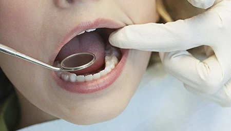 Understanding The Importance Of Oral Cancer Screening