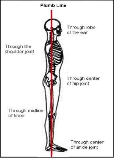 “Locked Knees” vs. “Soft Knees,” Which is Safer? - City View Chiropractic