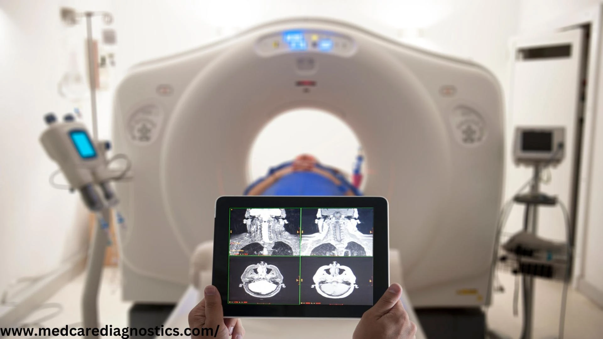 Things You Should Know About PET Scan For The Brain
