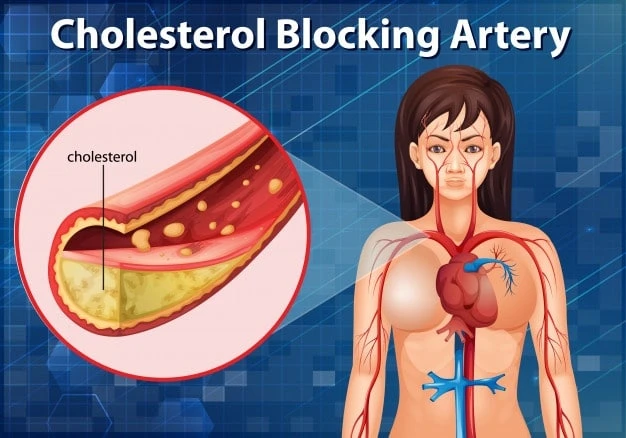 What is cholesterol? How to lower it?