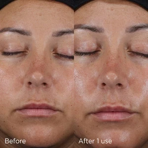 5 Ways to Pamper Your Skin for the Summer