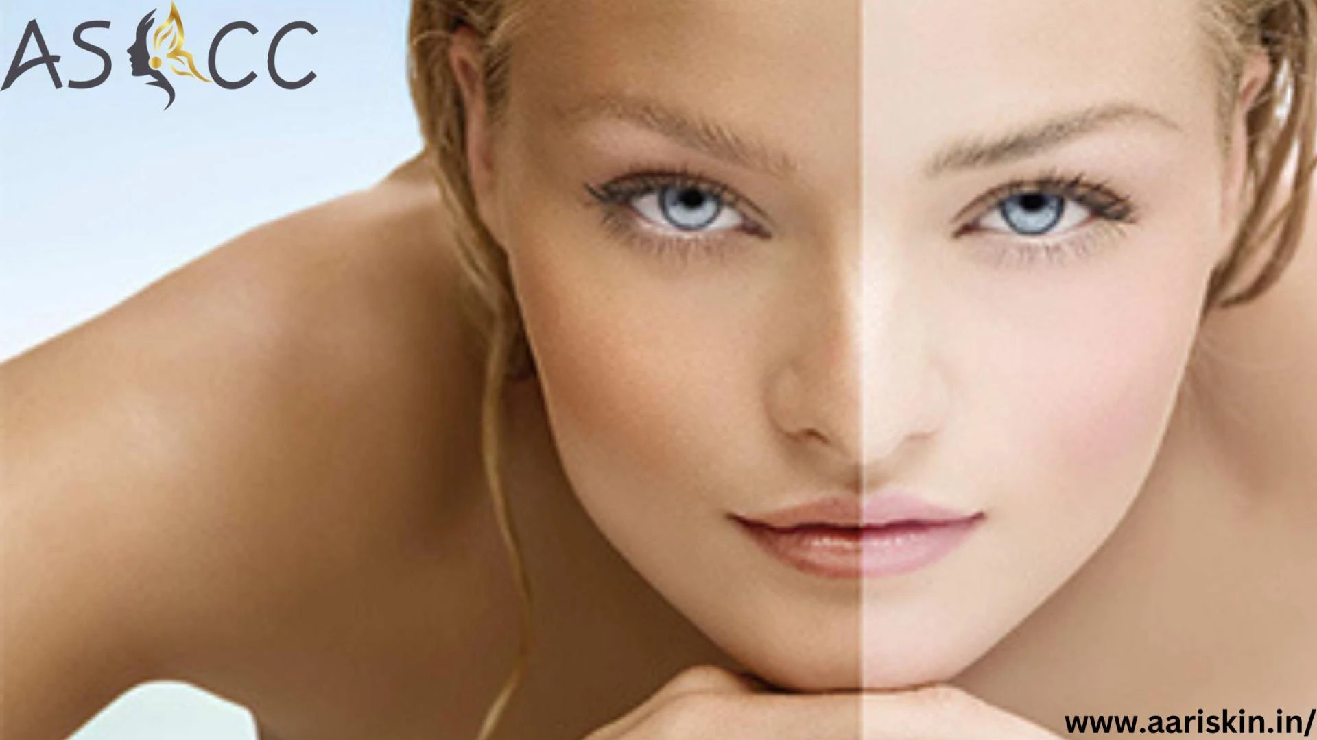 Face Skin Pigmentation Treatment In Jaipur
