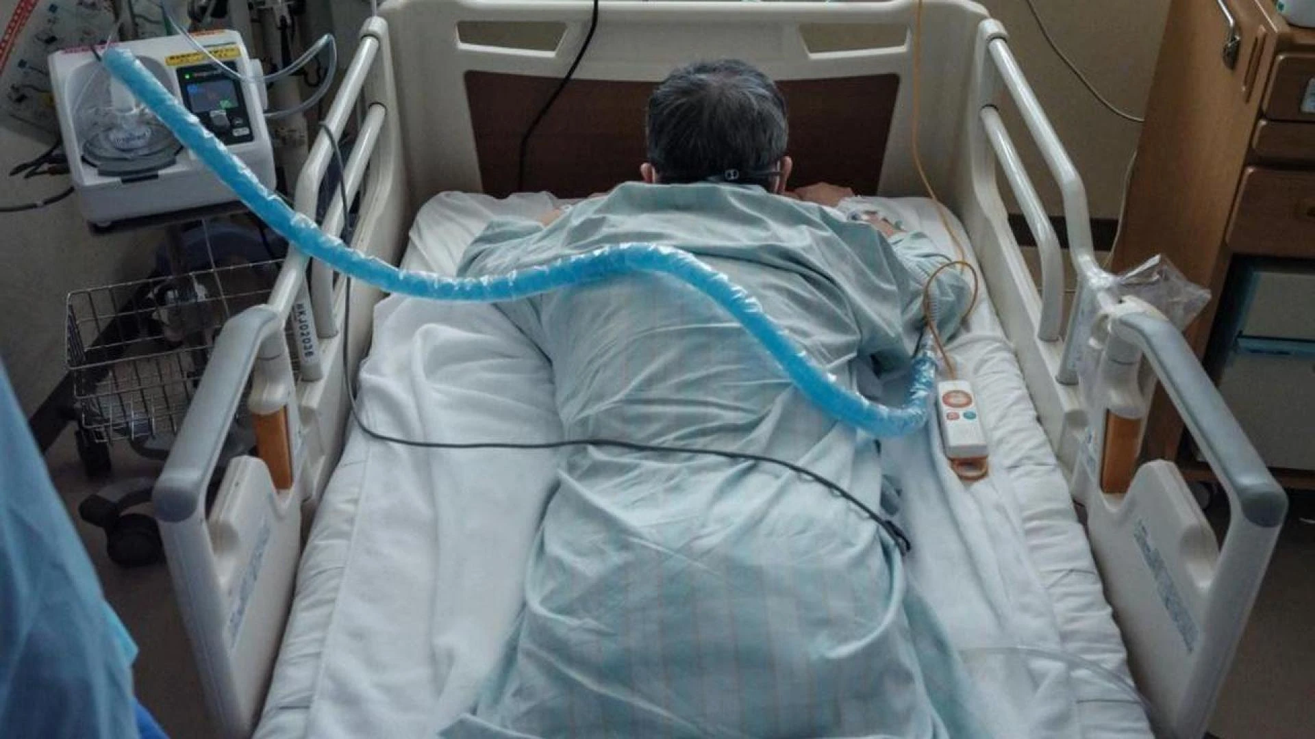 Restless Anal Syndrome | Post Covid Centers