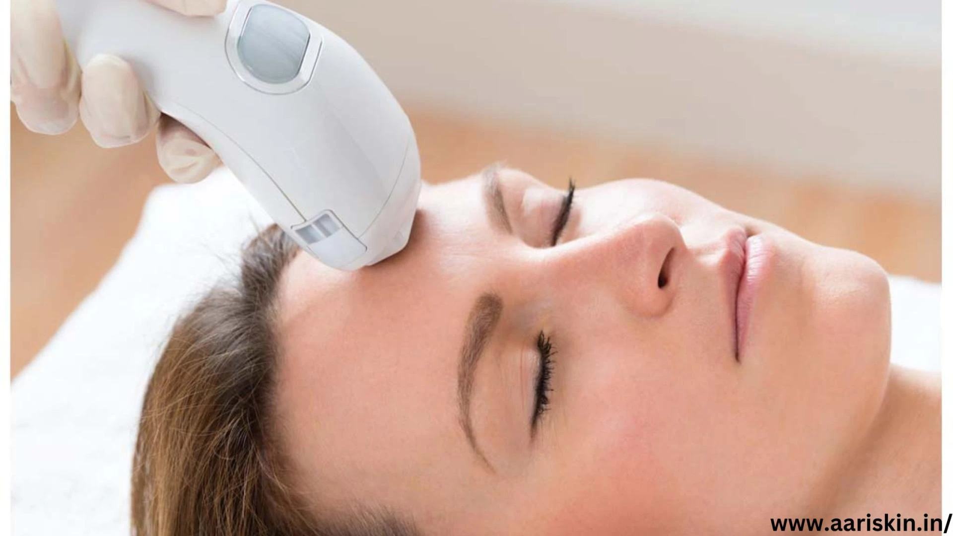 6 Incredible Benefits Of A Photofacial How It Works &amp; Benefits,