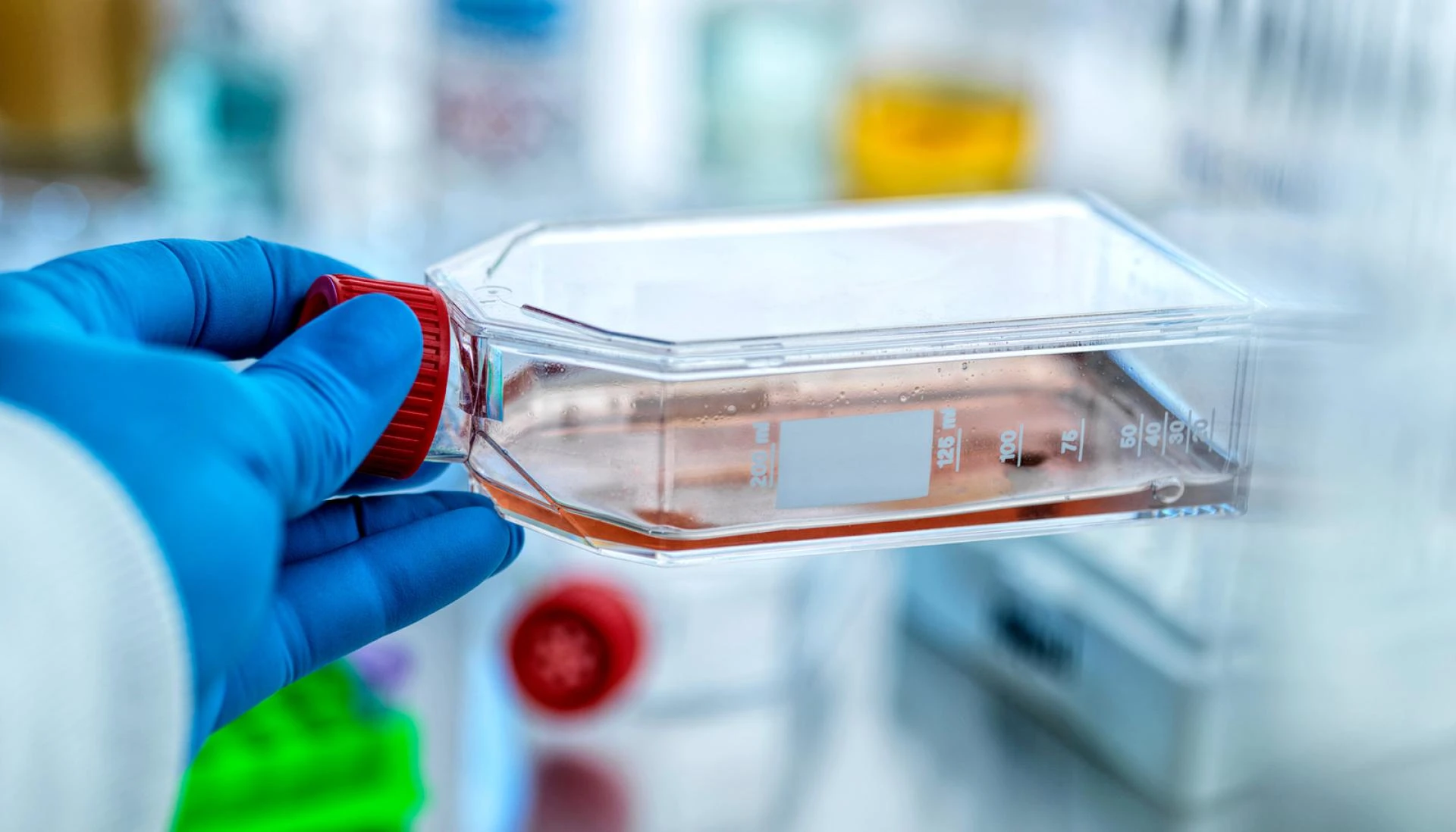 5 Things to Know Before Hiring a Stem Cell Therapy Marketing Agency