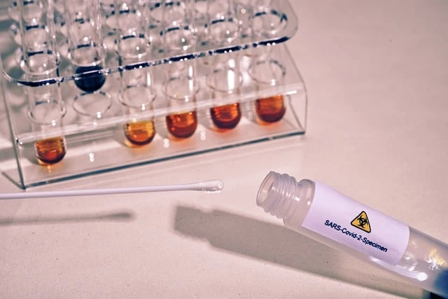 Why Are Filter Tips Essential For COVID PCR Tests