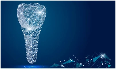 Understanding All on 4 Dental Implants and Their Benefits | Gresel Dental Hayward