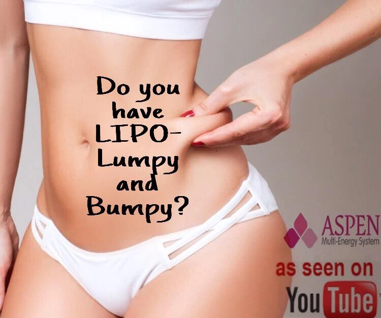 Certain Facts That You Must Know About Liposuction Fibrosis!