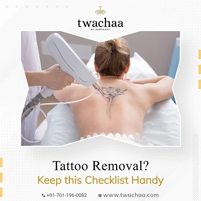 Make A Checklist Before You Go for A Tattoo Removal Session