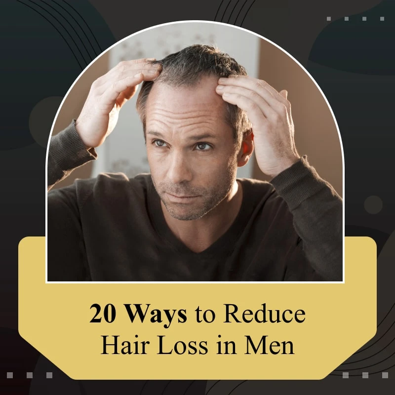 20 Ways to Reduce Hair Loss in Men
