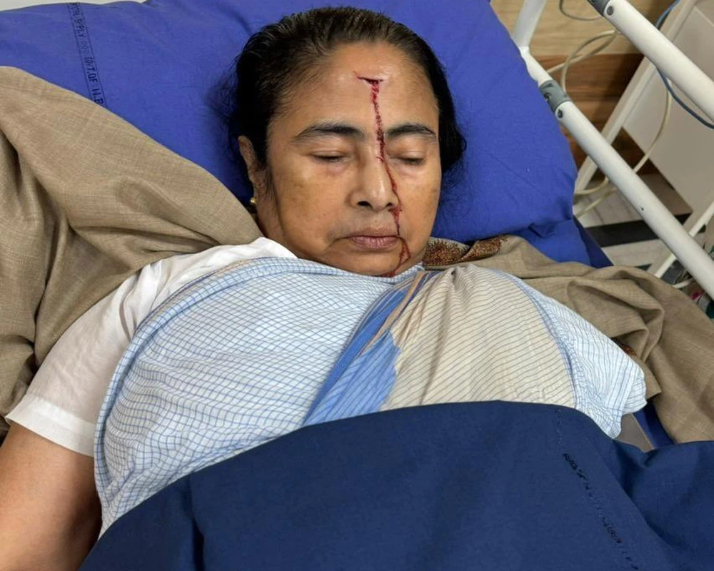 Doctor clarifies "confusion" over Mamata's fall, says it was "sensation of pushing from behind"
