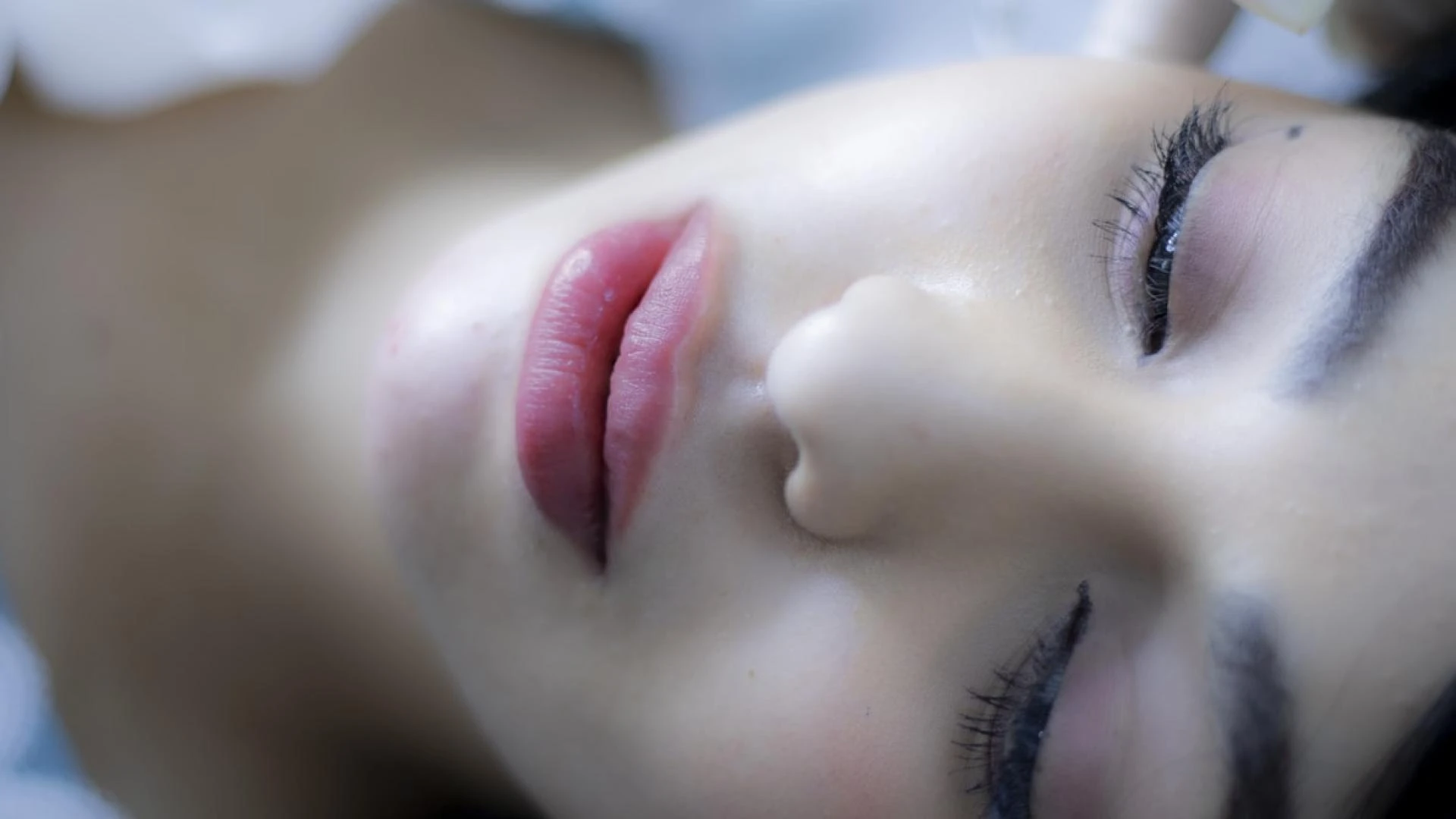 Dermal Fillers V/S Covid 19 Vaccine