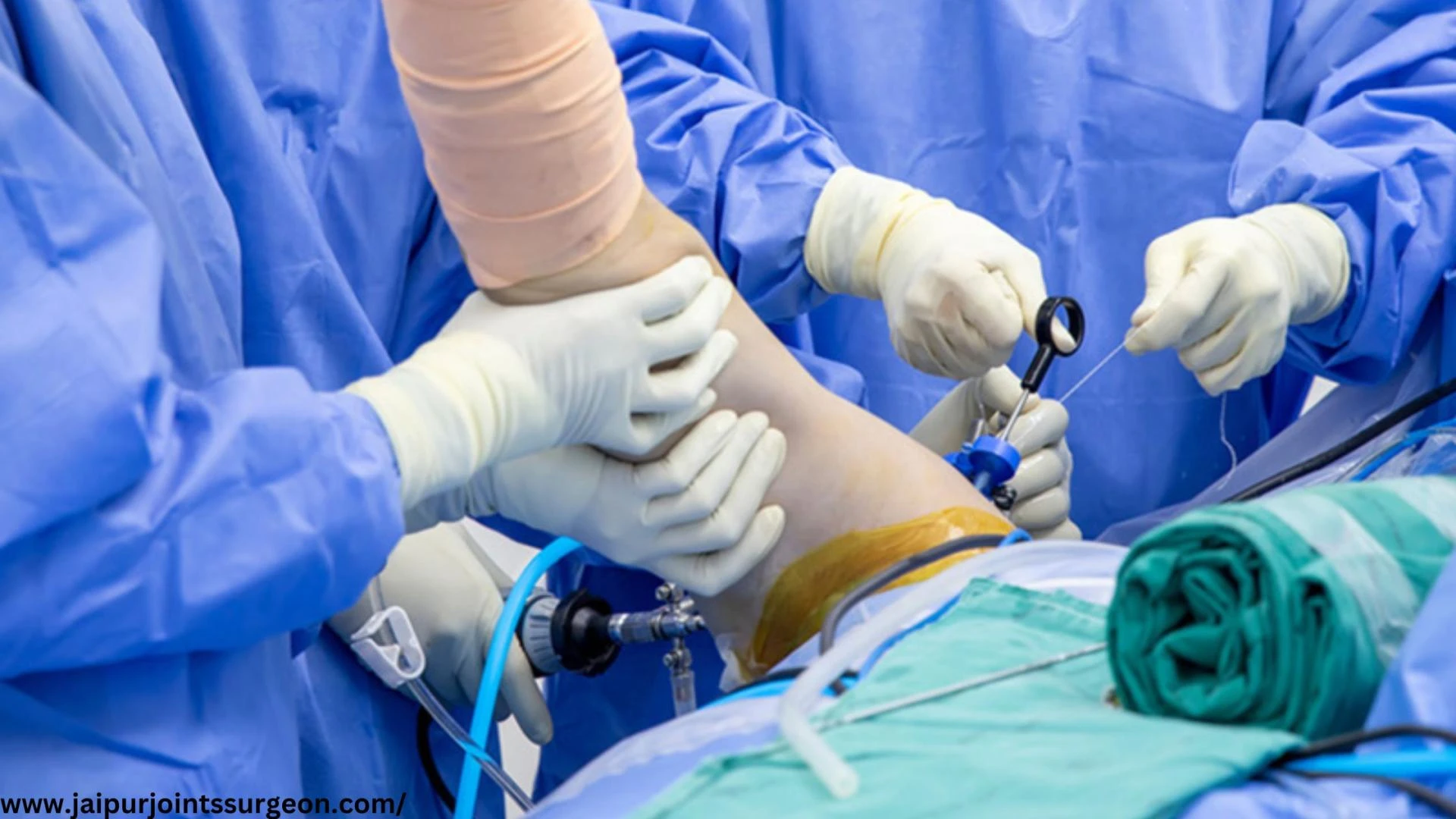 Best Shoulder Arthroscopy Treatment In Jaipur