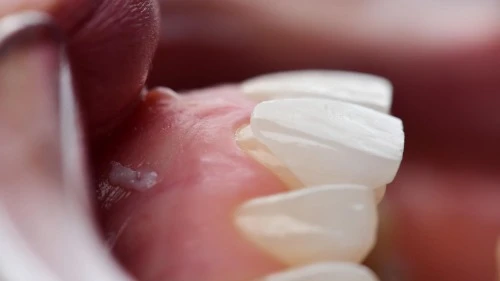 Is Cosmetic Dentistry Affecting Ethics and Aesthetics?