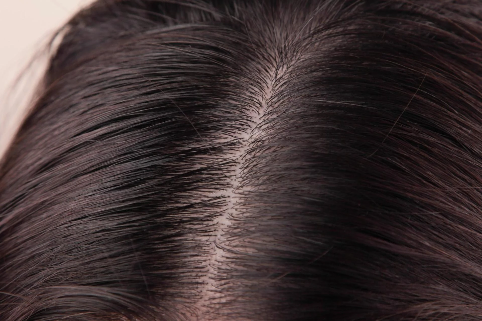 Tips for a healthy scalp