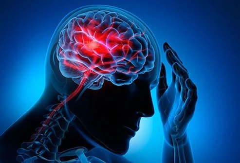 Impact of COVID-19 Outbreak on Global Ischemic Stroke Market - Drivers, Opportunities and Forecast Analysis to 2027
