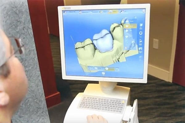 Cosmetic Dentistry Has Various Health Benefits