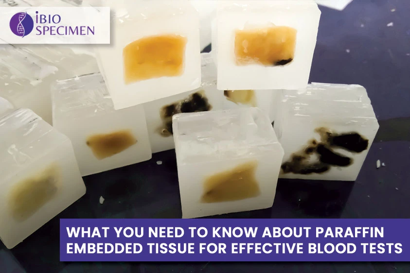 What You Need to Know About Paraffin Embedded Tissue for Effective Blood Tests