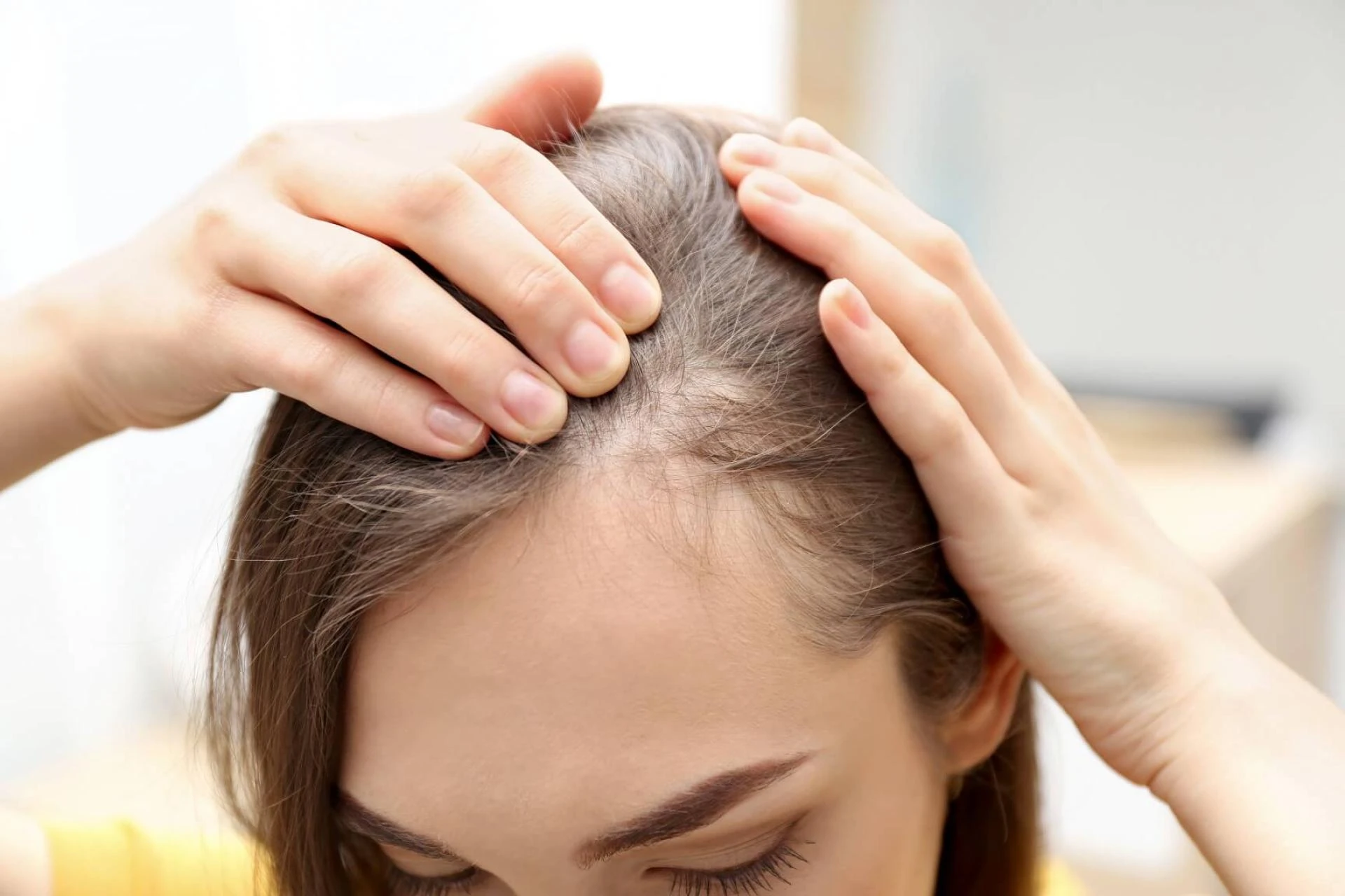Covid-19 Impact on Alopecia Treatment Market, Forecast 2021-2028