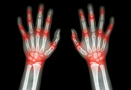 Sports medicine treatments that work