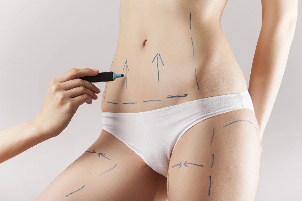 Advanced Liposuction Treatment for Fat Removal