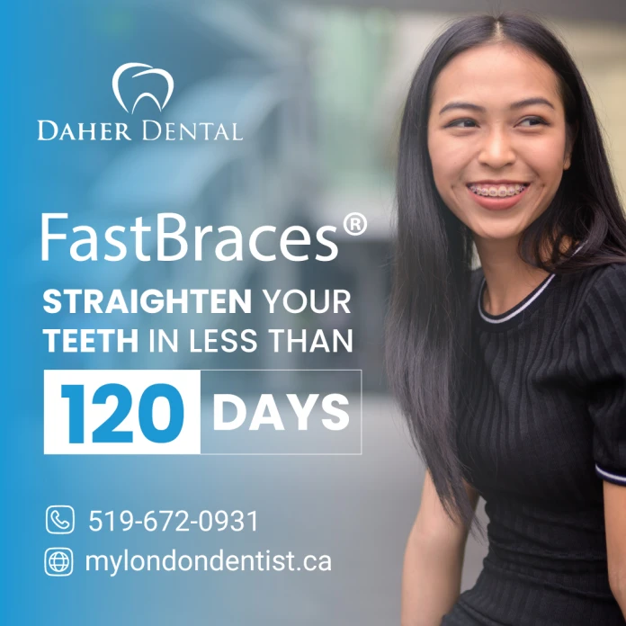 Fast Braces Before and After | My London Dentist