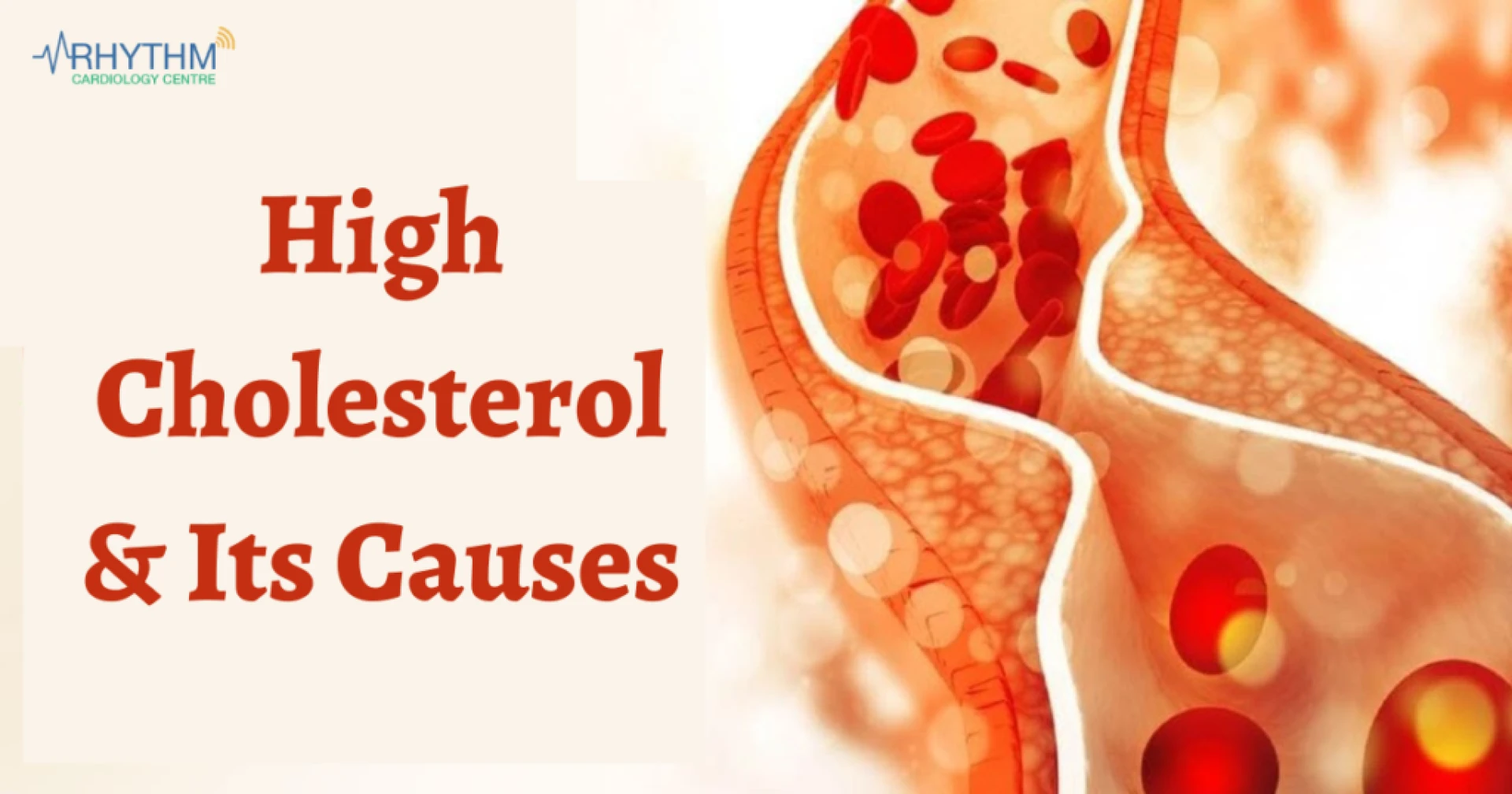 What Do the Cholesterol Levels in My Blood Mean? Heart Specialist