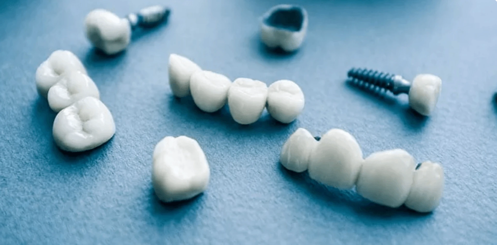 7 Restorative Dentistry Procedures Your Dentist Might Recommend