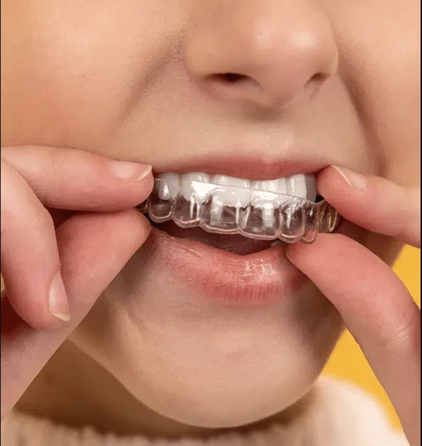 Services in Cosmetic Dentistry