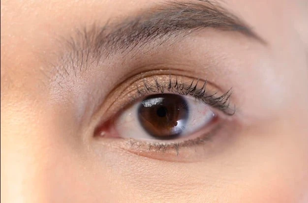 What is medically-necessary eyelid surgery? Do I need it?