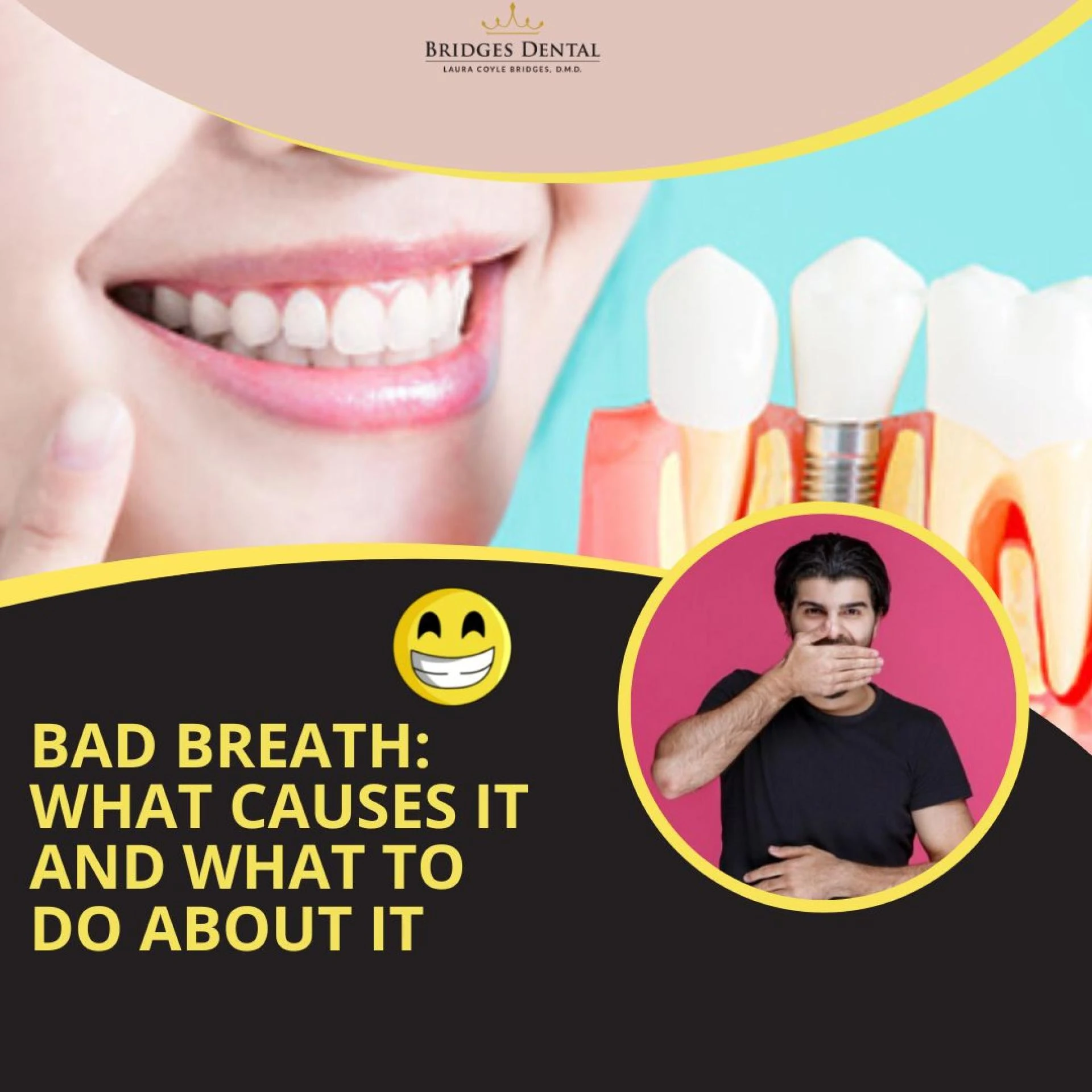Bad breath: What causes it and what to do about it