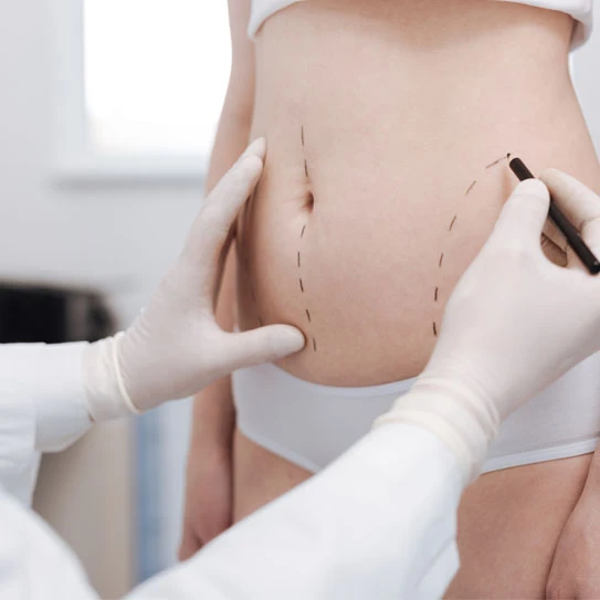 10 Tips for Finding the Best Lipo in Punjab for Liposuction