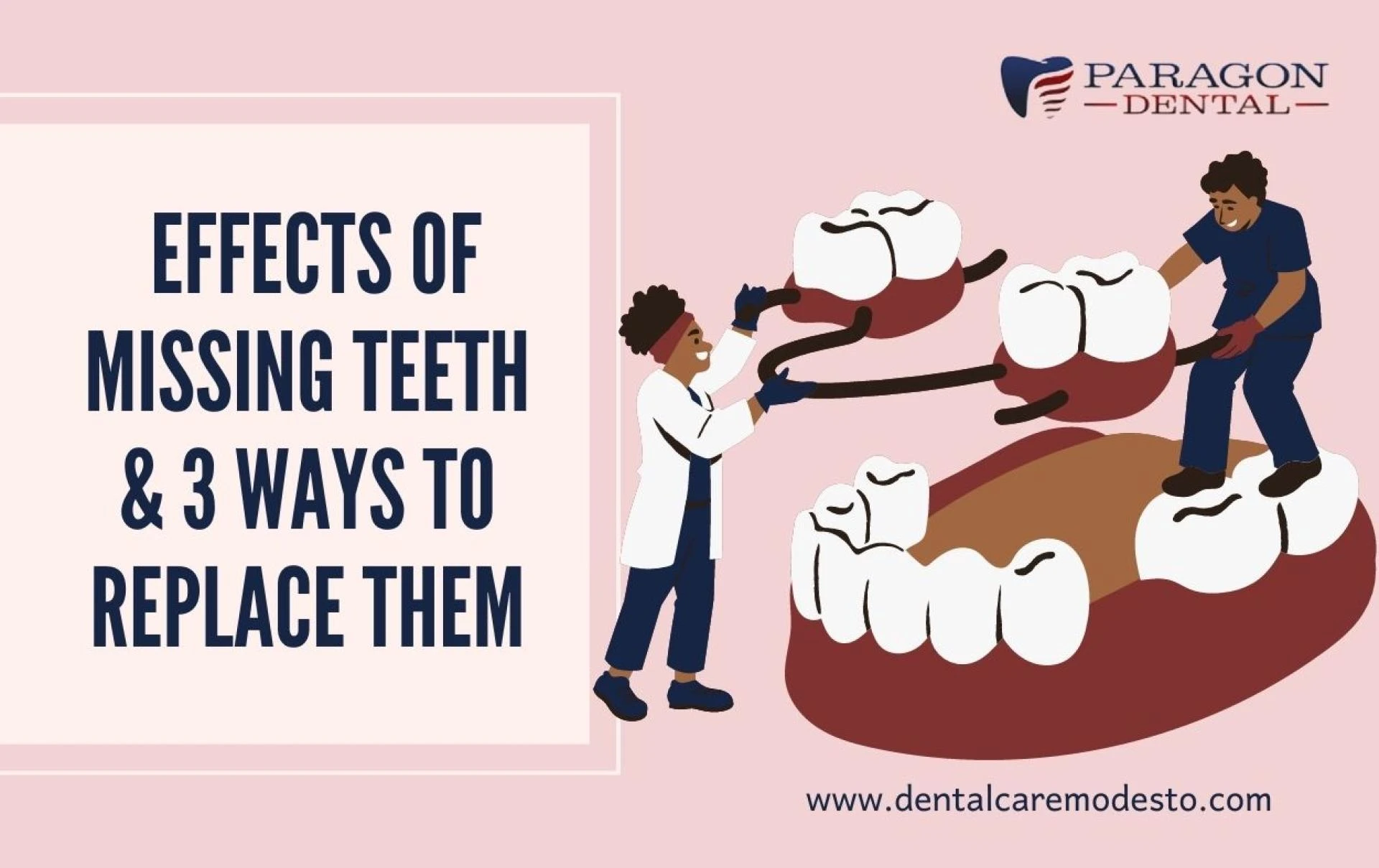 Effect of Missing Teeth &amp; 3 Ways to Replace Them