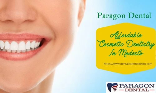 Affordable Cosmetic Dentistry In Modesto