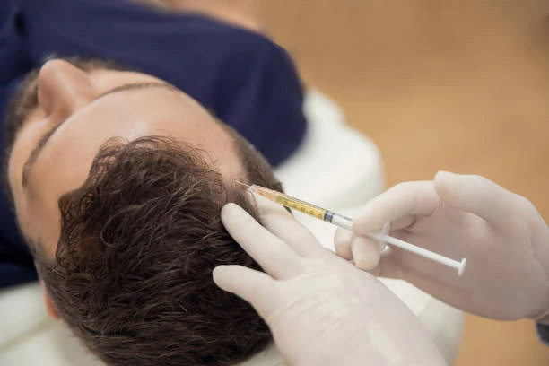 Enhancing Hair Restoration: FUE Hair Transplant and PRP Hair Treatment in Jeddah