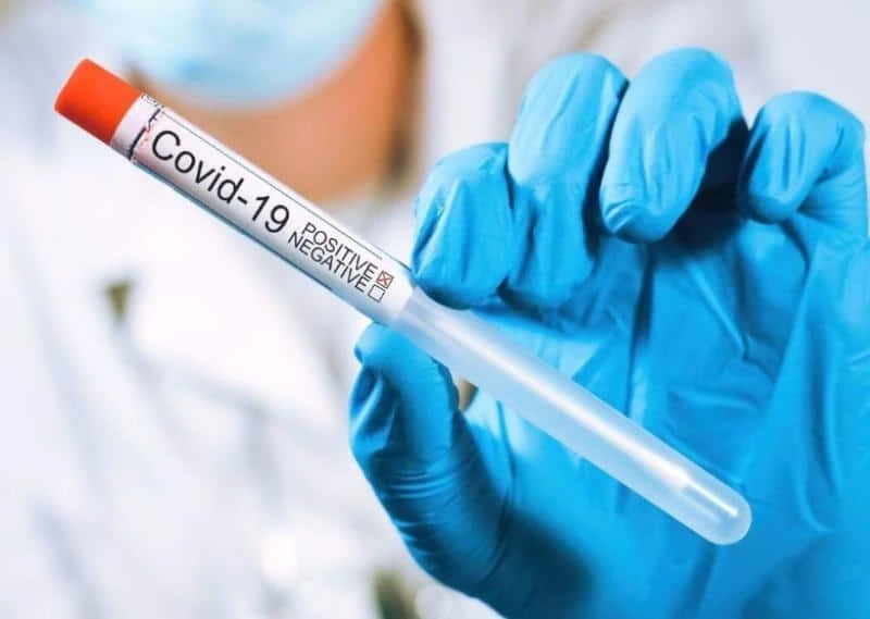 Is a PCR Test Necessary Before Air Travel in Toronto?