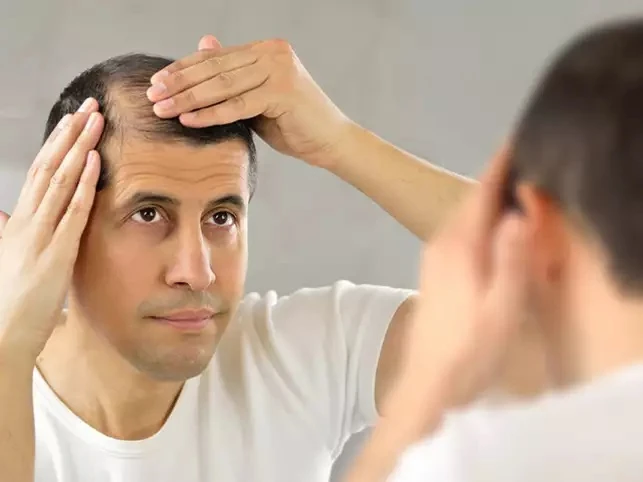 Explain PRP Hair Restoration And Its Effectiveness