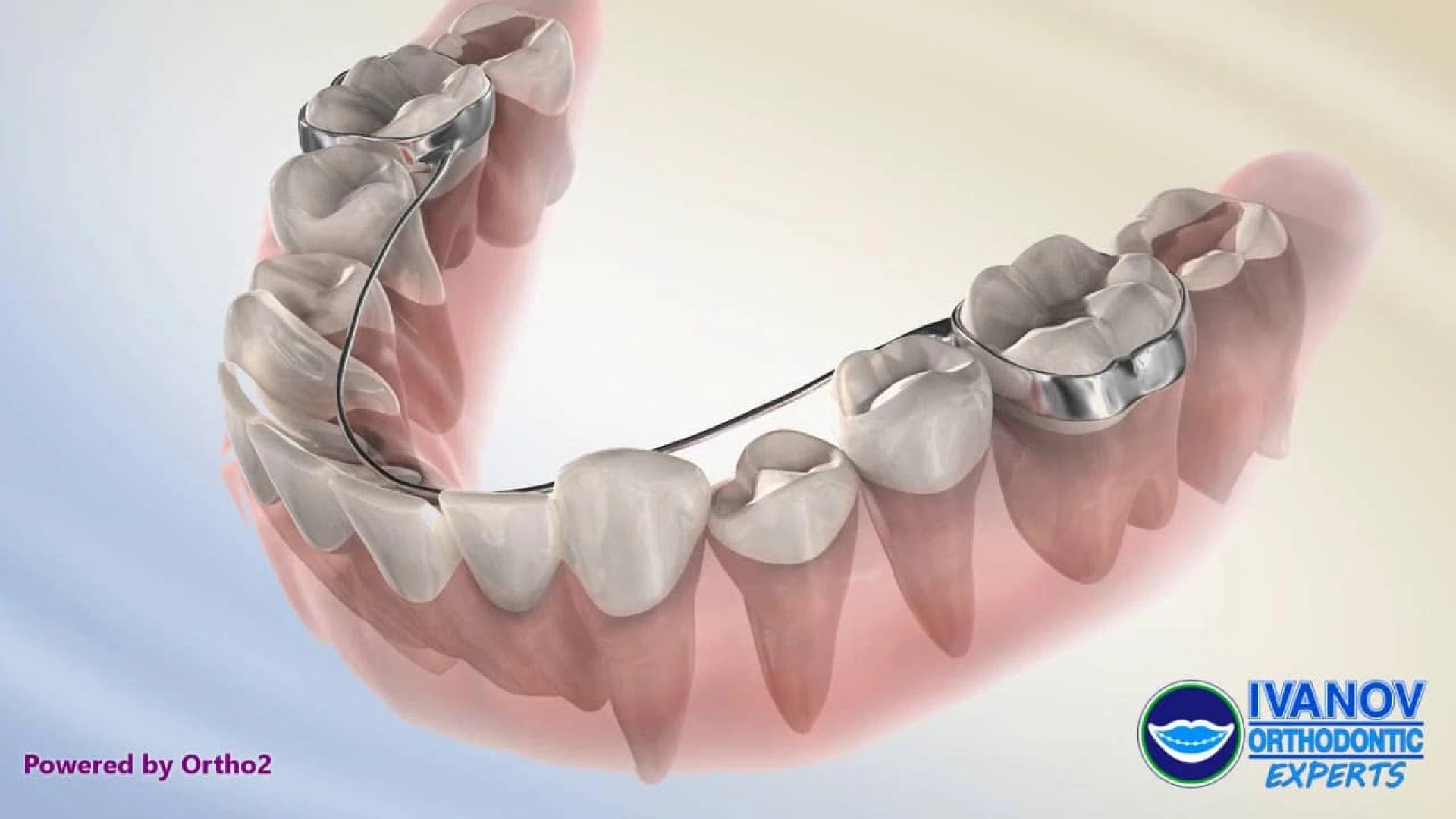 What To Look For In An Orthodontist?