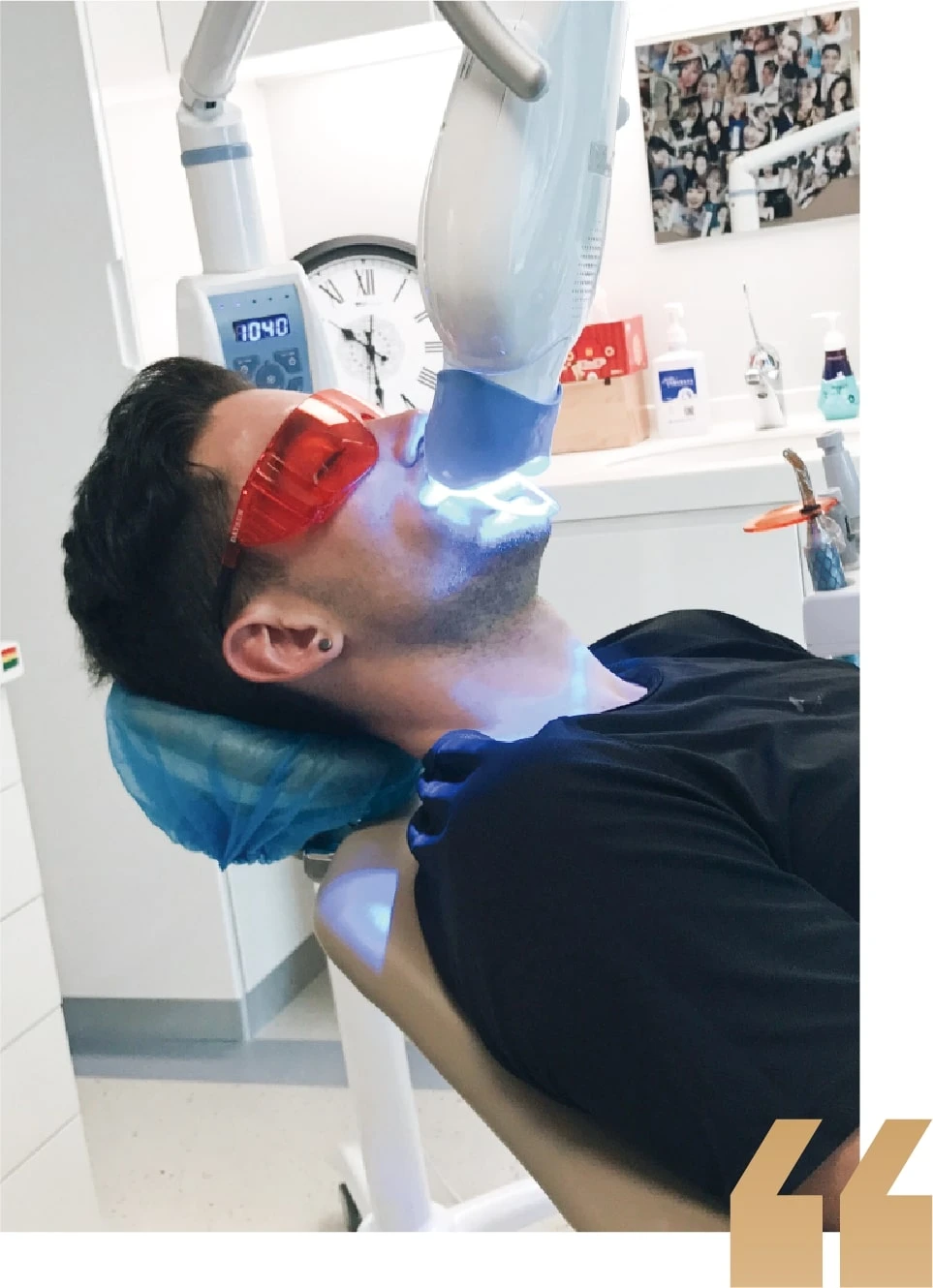 What Are the Benefits of Teeth Whitening?