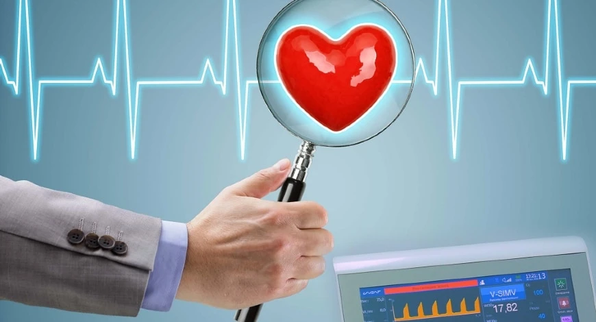 ECG Management System Market Report | Regional Analysis &amp; Keyplayers