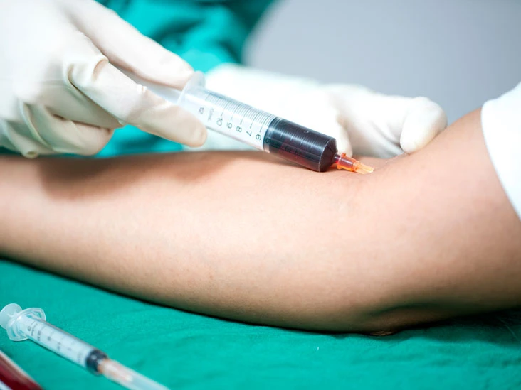 Blood Stream Infection Testing Market Excellent Growth 2021 Top Key Players