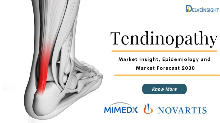 What is Tendinopathy?