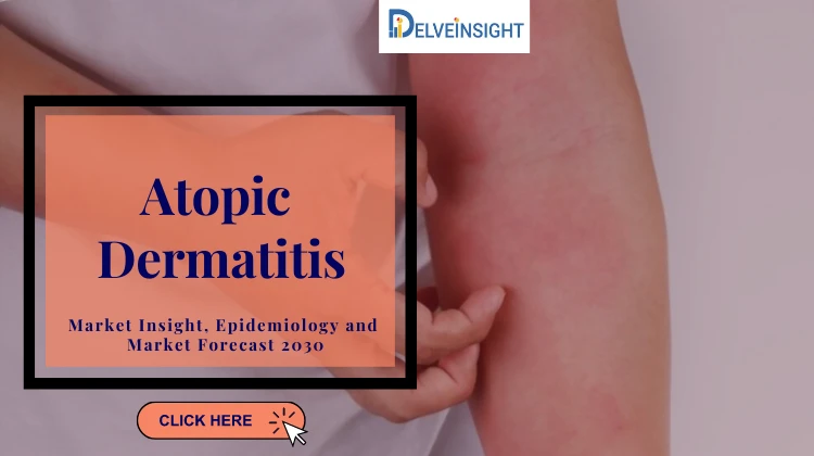 What is Atopic Dermatitis Market?