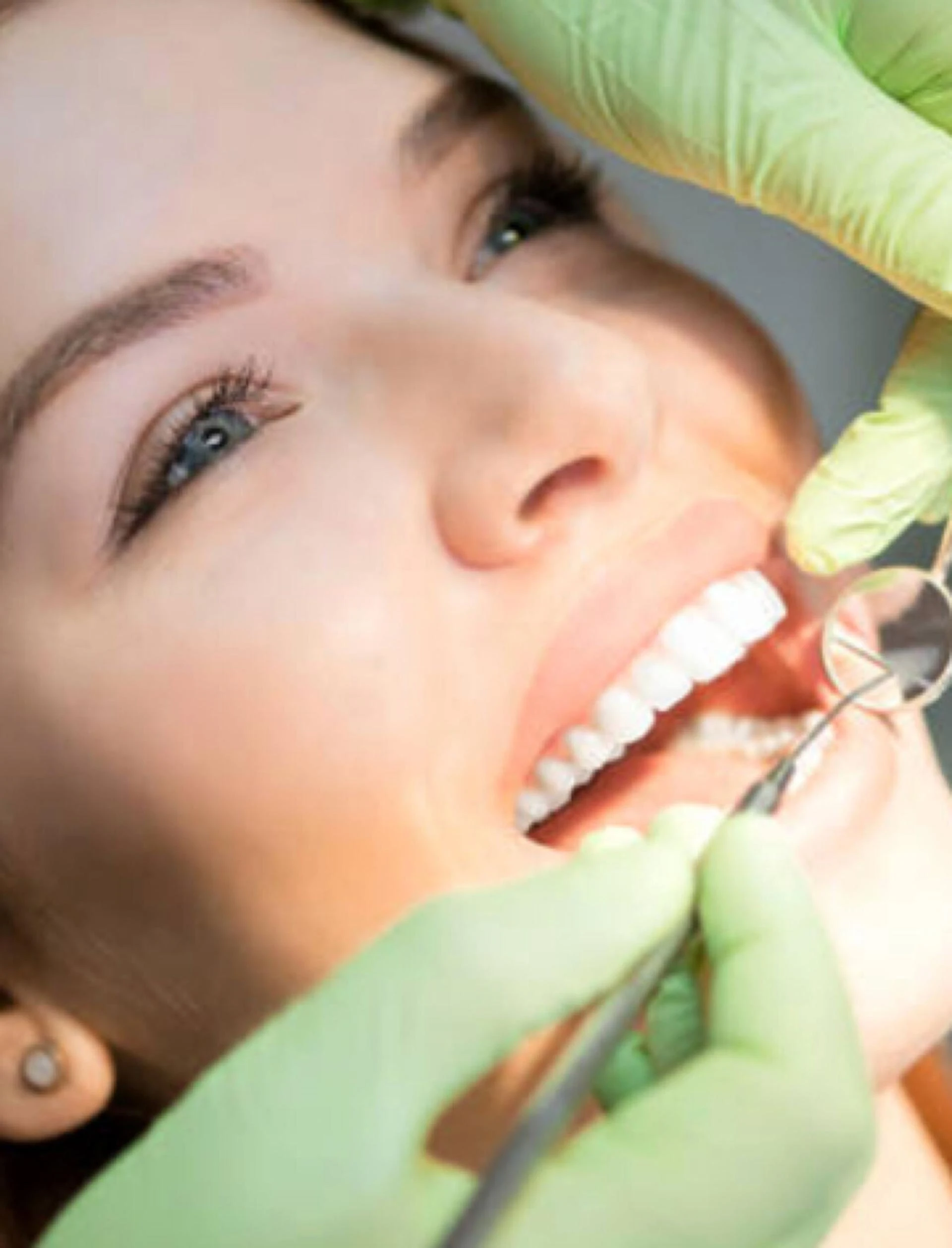 Crooked Teeth Can Result In TMD