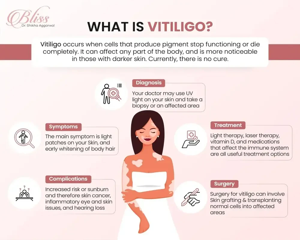 Vitiligo Treatment in Ludhiana