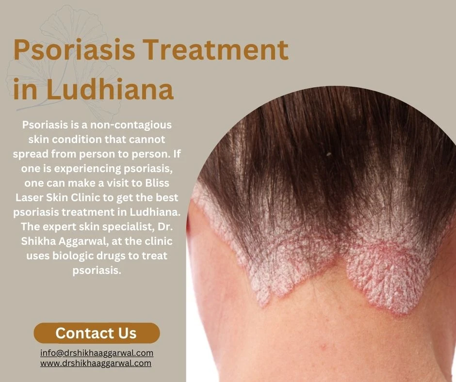Psoriasis Treatment In Ludhiana by Dr. Shikha Aggarwal