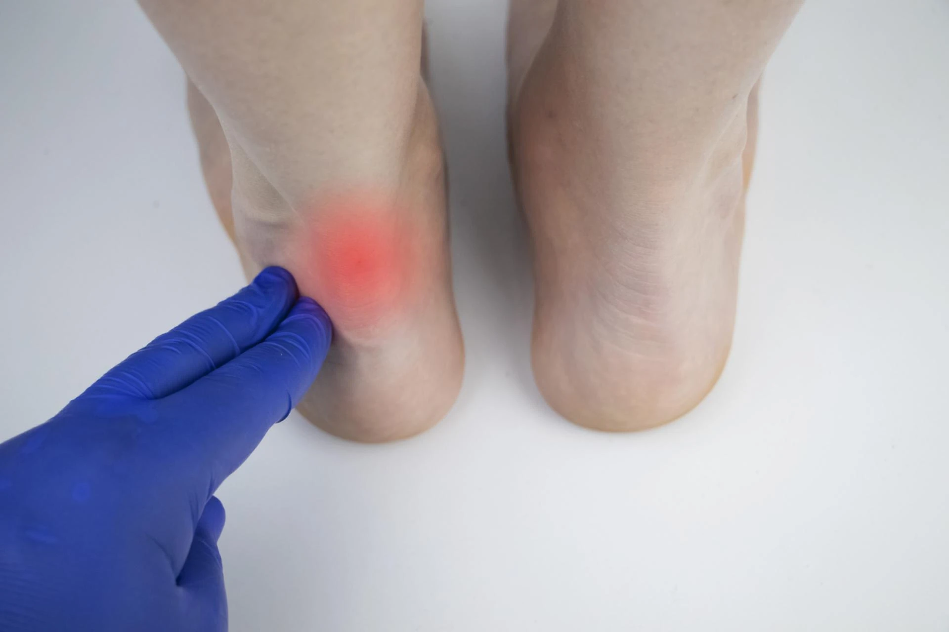 Regenerative medicine and personalized medicine