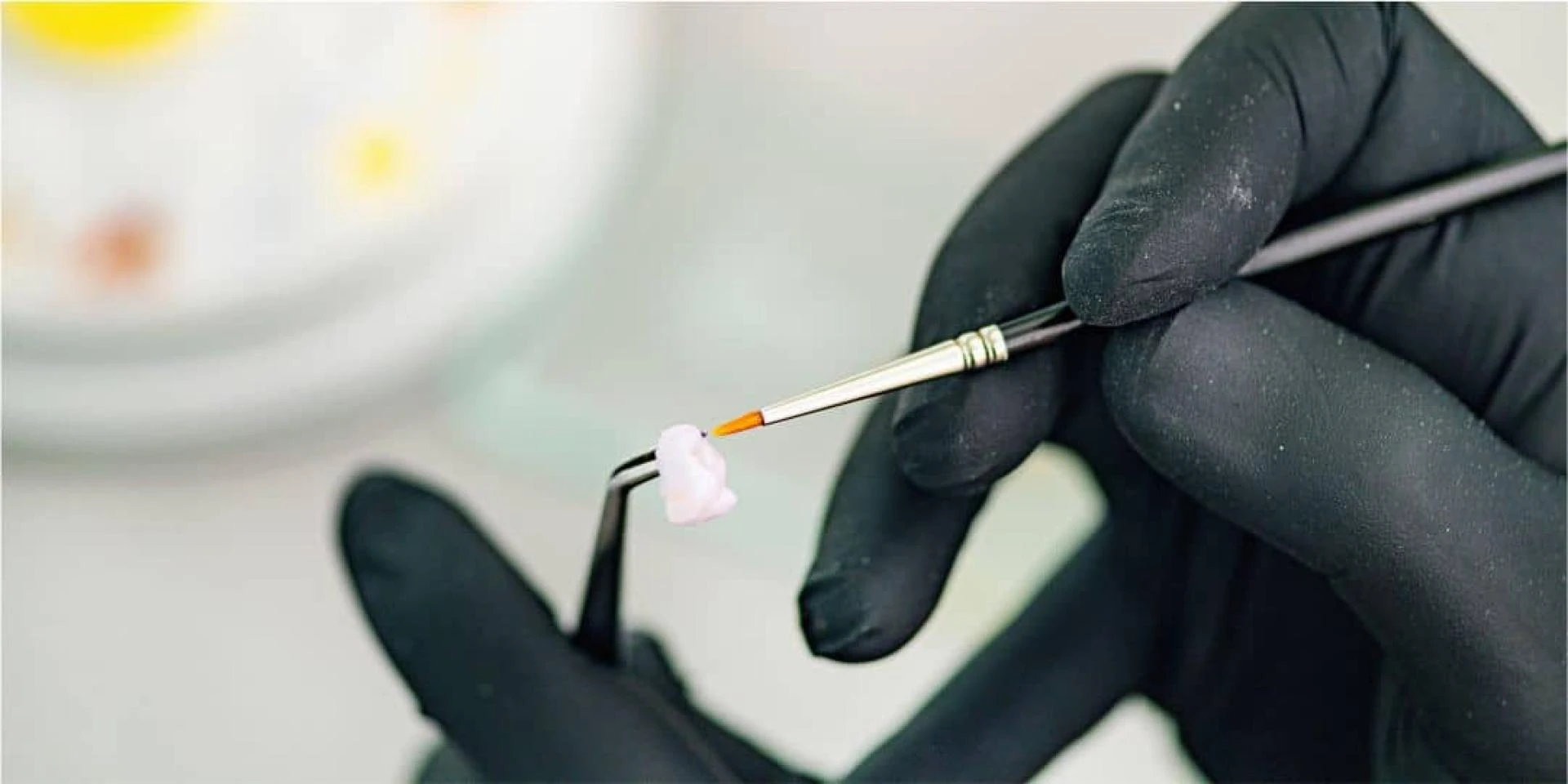 7 Reasons Why You Need Dental Crowns