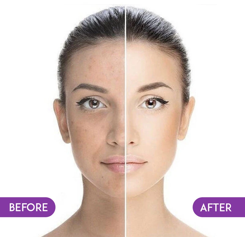 What is BB Glow Treatment?